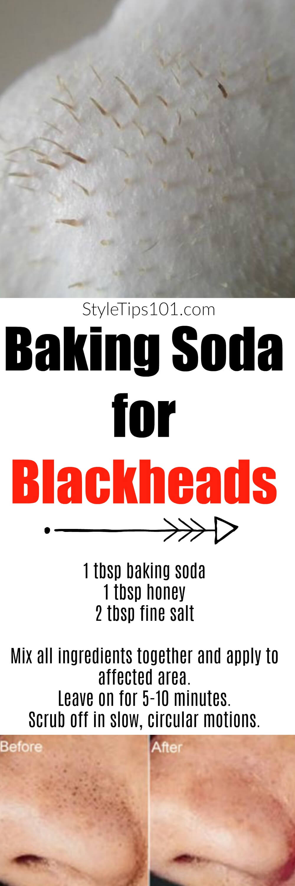 baking soda for blackheads reviews